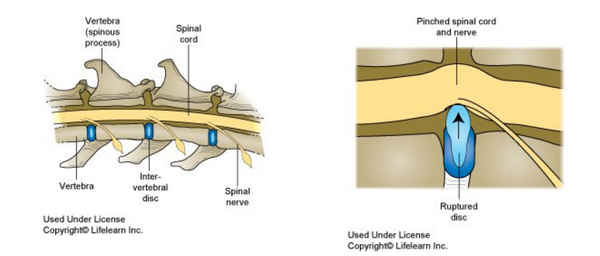 Intervertebral Disc Disease In Dogs – SingVet Animal Clinic